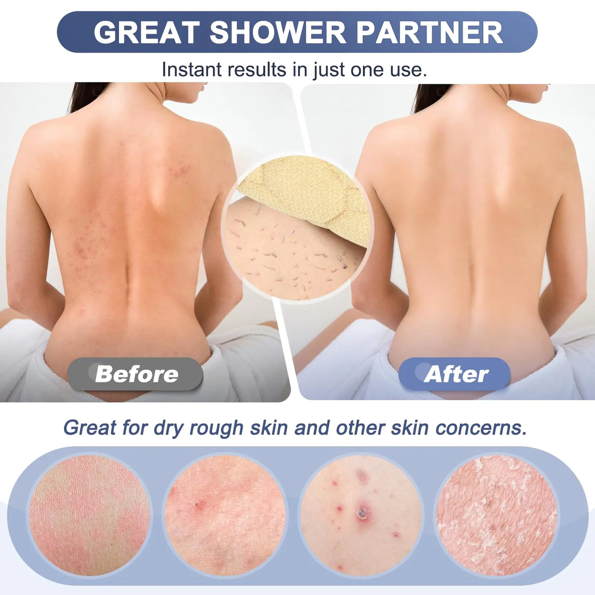 Exfoliating Back Scrubber with Handles, 39 Inch Double-Sided Back Exfo ...